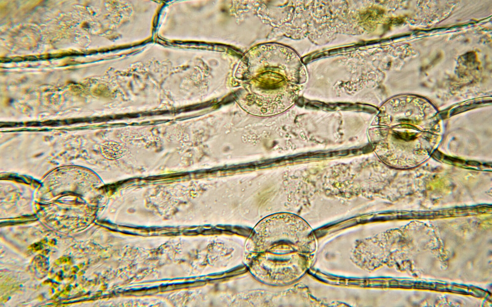 Кожица традесканции под микроскопом. Клетка эпидермы листа традесканции виргинской. Хлорофитум устьица. Микропрепарат эпидермис листа традесканции. Эпидерма микрофотография.